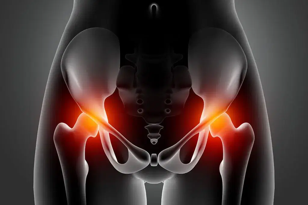 Hip Replacement Options in Manchester