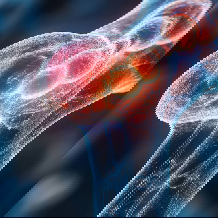 inflamed joint medical illustration