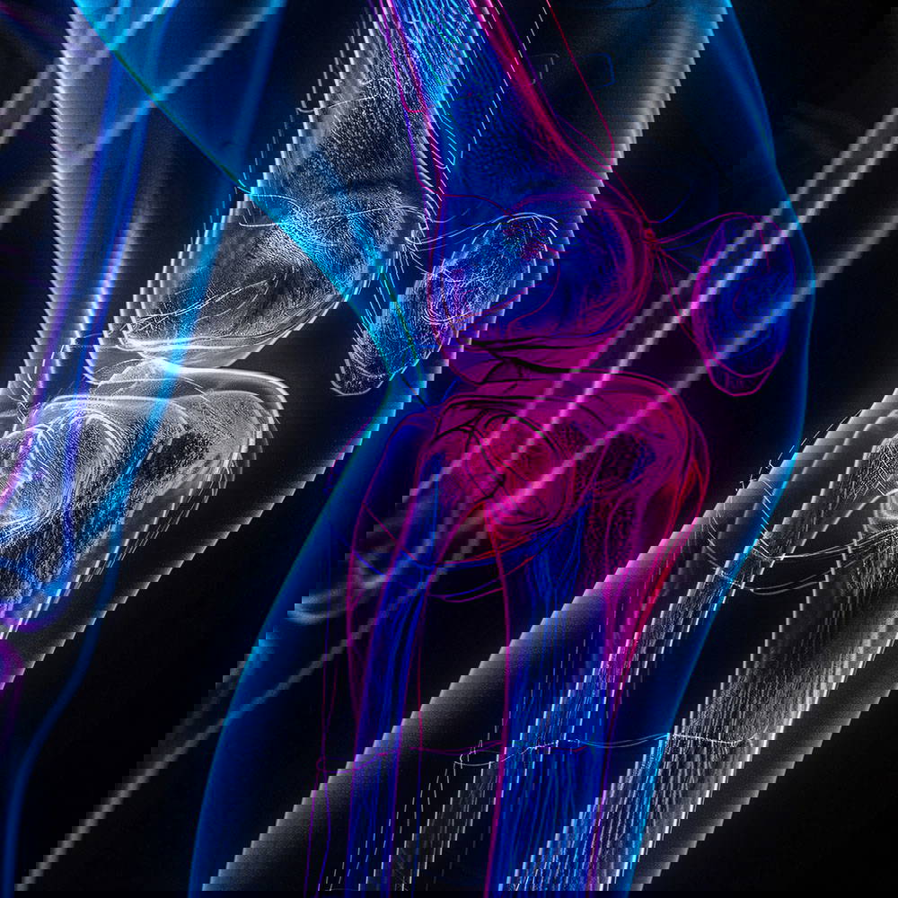 knee x ray with neon colours