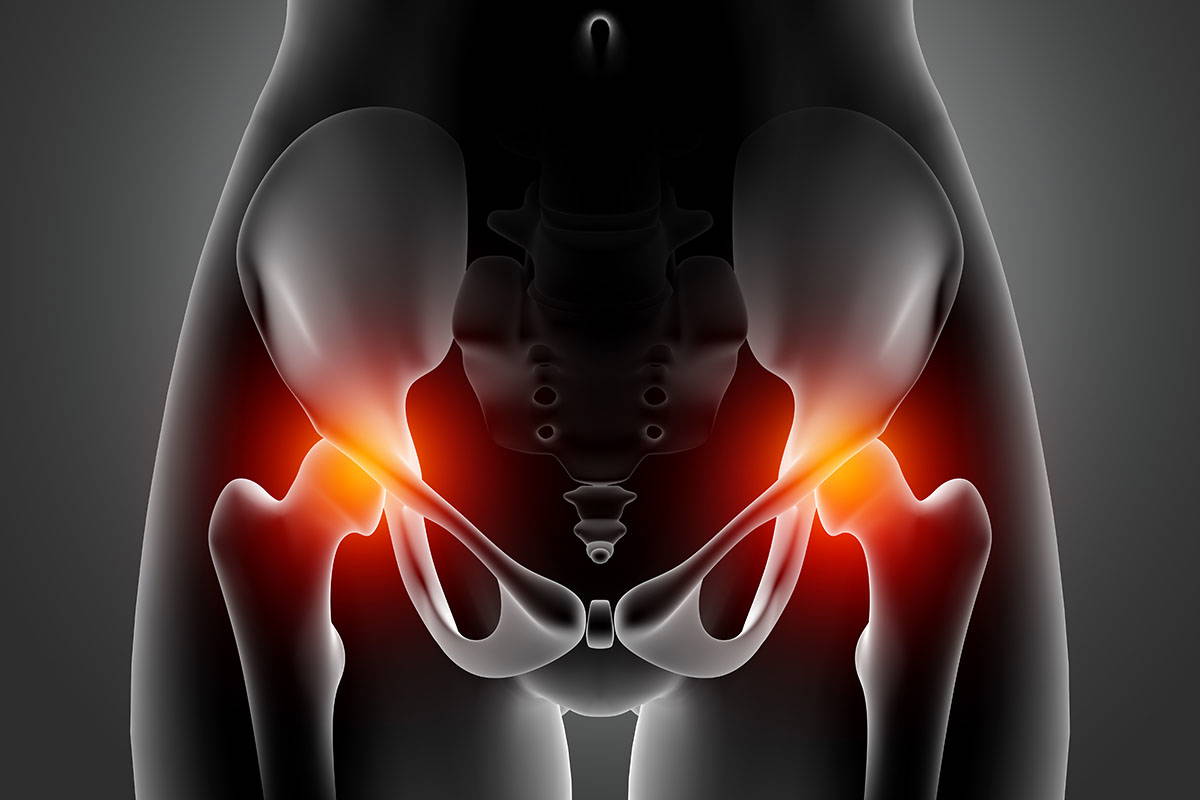 Hip Replacement Options in Manchester
